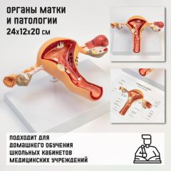 Макет «Органы матки, патологии» 24x12x20см
