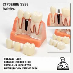 Макет «Строение зуба» 9x6x9см