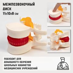Макет «Межпозвоночный диск» 11x10x8см