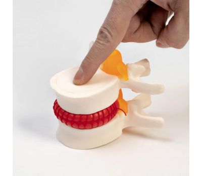 Макет межпозвоночного диска 11x10x8 см для изучения анатомии, изображение 2