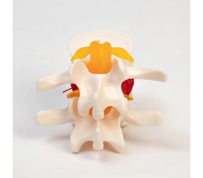 Макет межпозвоночного диска 11x10x8 см для изучения анатомии, изображение 3