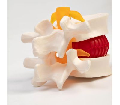 Макет межпозвоночного диска 11x10x8 см для изучения анатомии, изображение 5