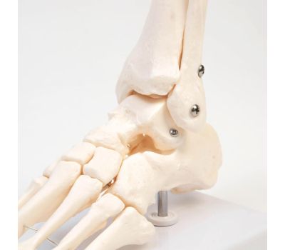 Макет «Голеностопный сустав человека» 21x20 см – Высококачественная анатомическая модель, изображение 4