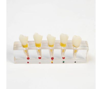 Макет строения зуба и заболеваний: изучайте анатомию зубов с удовольствием!, изображение 2