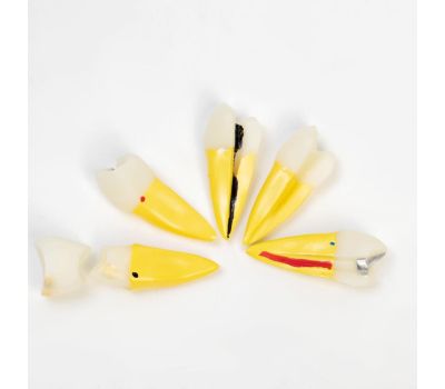 Макет строения зуба и заболеваний: изучайте анатомию зубов с удовольствием!, изображение 3